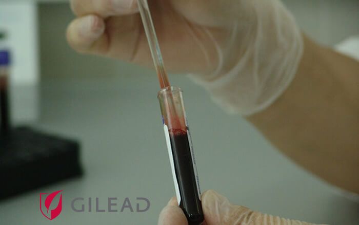 Gilead destina más de 21 millones de euros a la investigación del VIH