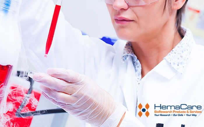HemaCare Corporation firma un acuerdo de distribución en Israel con Almog Diagnostics
