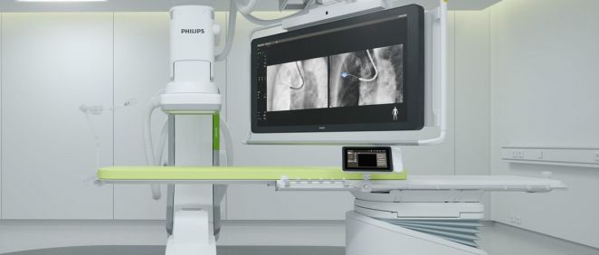 Philips amplía la red de nuevos socios para la utilización de la solución Lung Suite