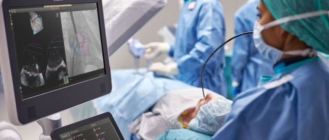 Philips lanza EchoNavigator 4.0 para tratar cardiopatías estructurales con más facilidad y eficacia