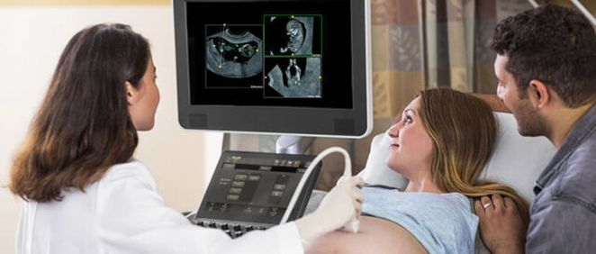 Philips presenta el software de intercambio de imágenes de ecografía fetal FetView