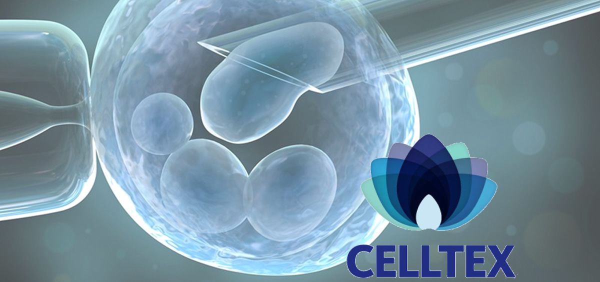 Celltex Therapeutics espera tener una terapia de células madre para el alzhéimer dentro de tres años