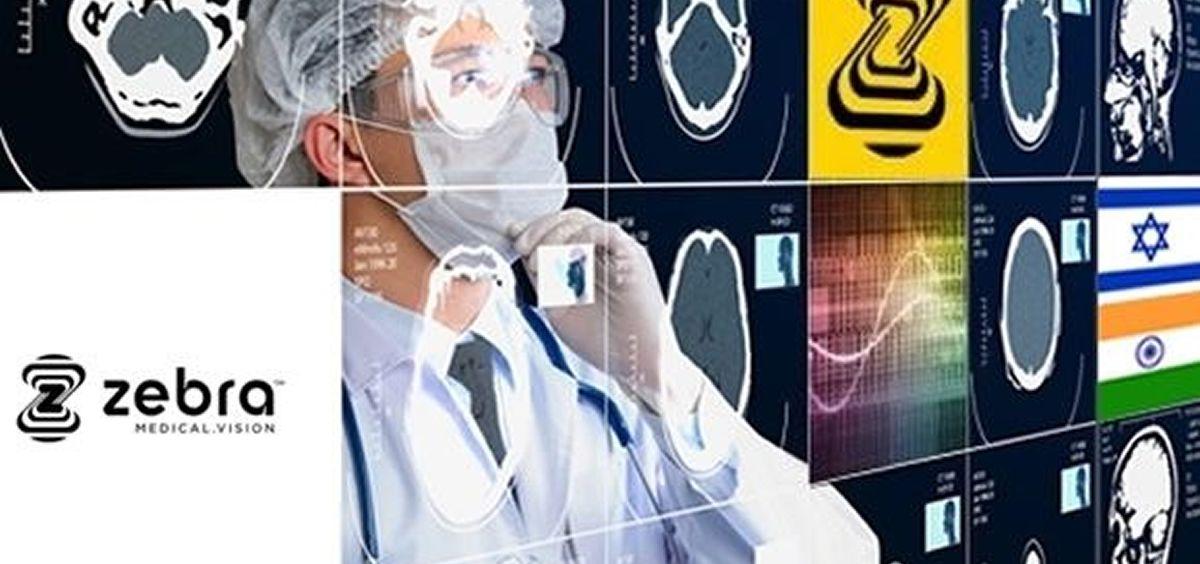 Zebra Medical Vision presenta el lector de rayos X torácicos más automatizado hasta la fecha