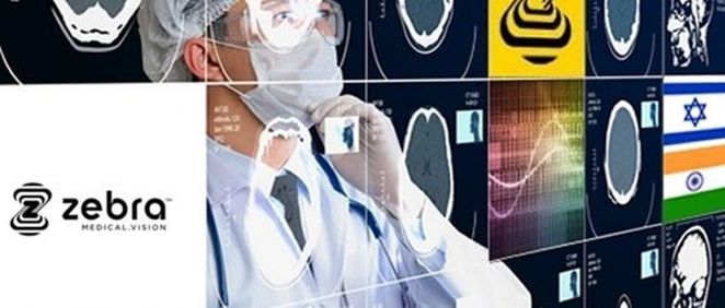 Zebra Medical Vision presenta el lector de rayos X torácicos más automatizado hasta la fecha