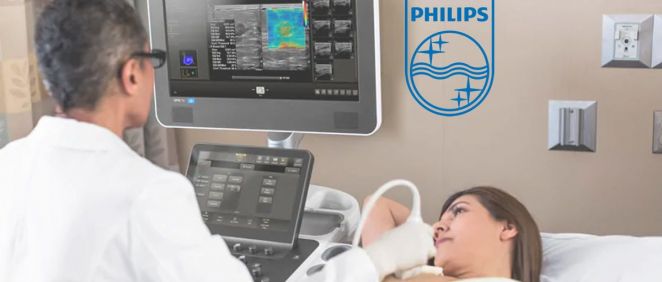 Philips lanza una solución de ultrasonido mamario más eficiente