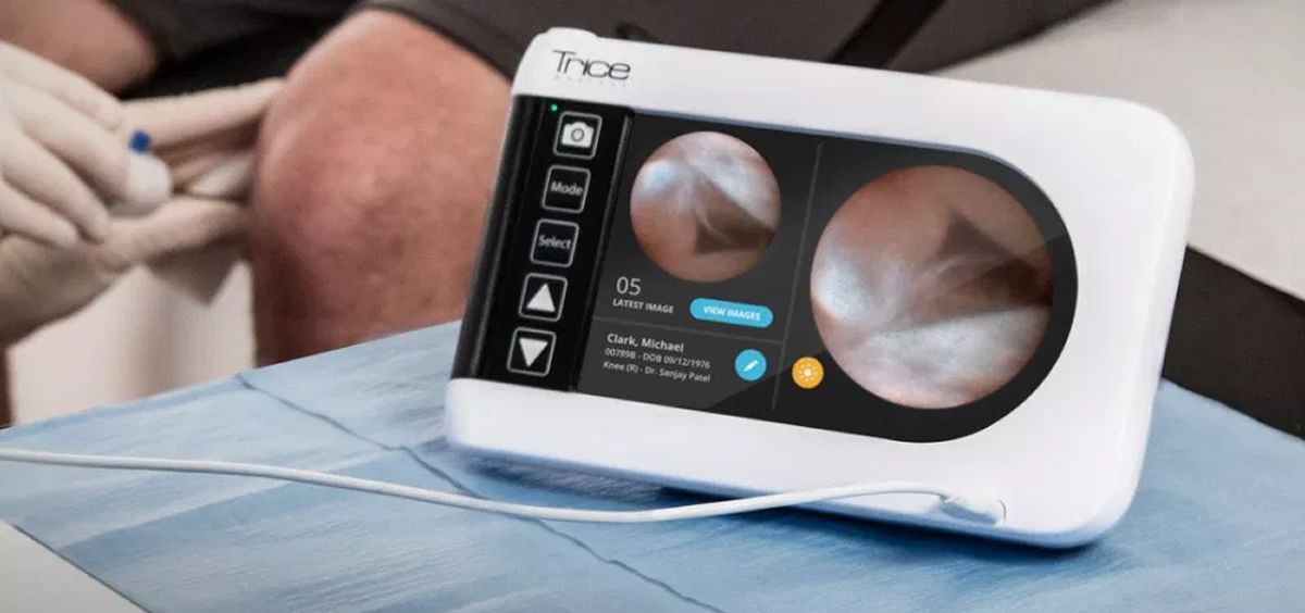 Trice adquiere SEG Way Orthopaedics para ofrecer soluciones ortopédicas mínimamente invasivas