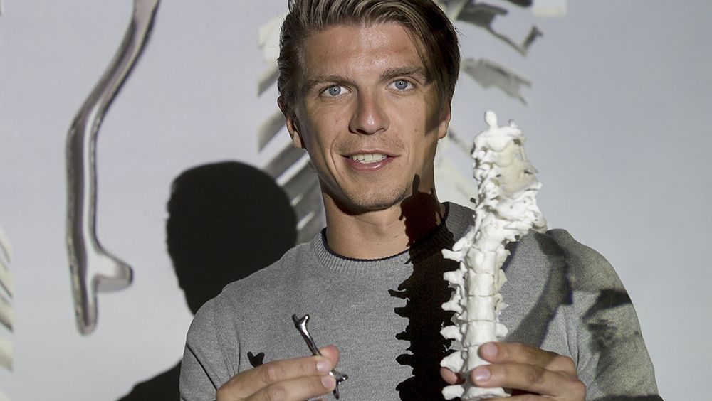 Modelo de implante óseo de titanio impreso en 3D (Foto. Centro Médico de la Universidad de Utrecht)