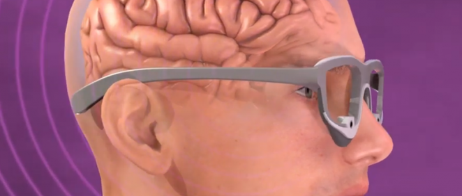 Implante cerebral con cámara un proyector de video (Foto. NIH)