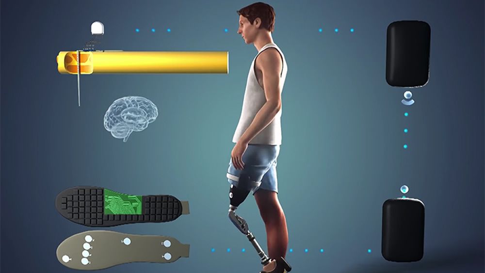 Esquema de cómo funciona la pierna protésica (Foto: ETH Zúrich)