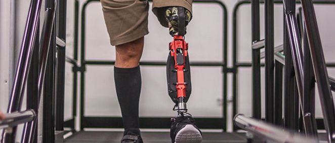 Una pierna protésica inteligente con inteligencia artificial. (Foto. Universidad de Utah)
