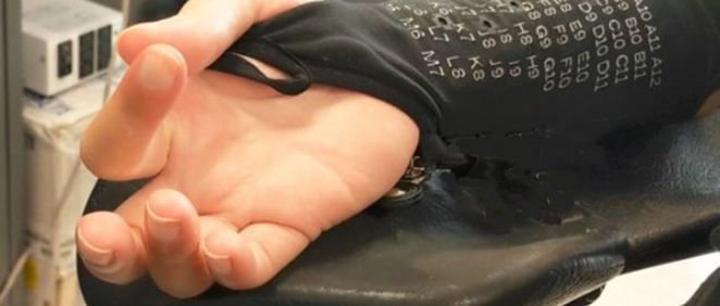Una funda bioelectrónica sobre la piel utilizada para ayudar a las personas con parálisis a mover los dedos. (Foto. Institutos Feinstein de Investigación Médica)