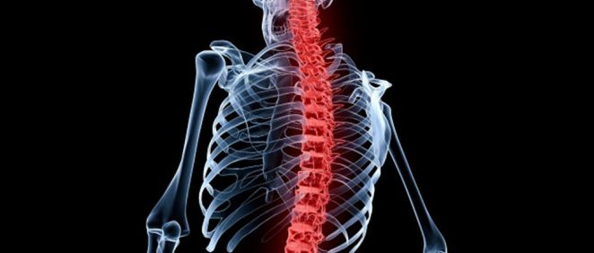 Implantes espinales de microelectrodos para controlar la función de extremidades paralizadas. (Foto. Freepik)