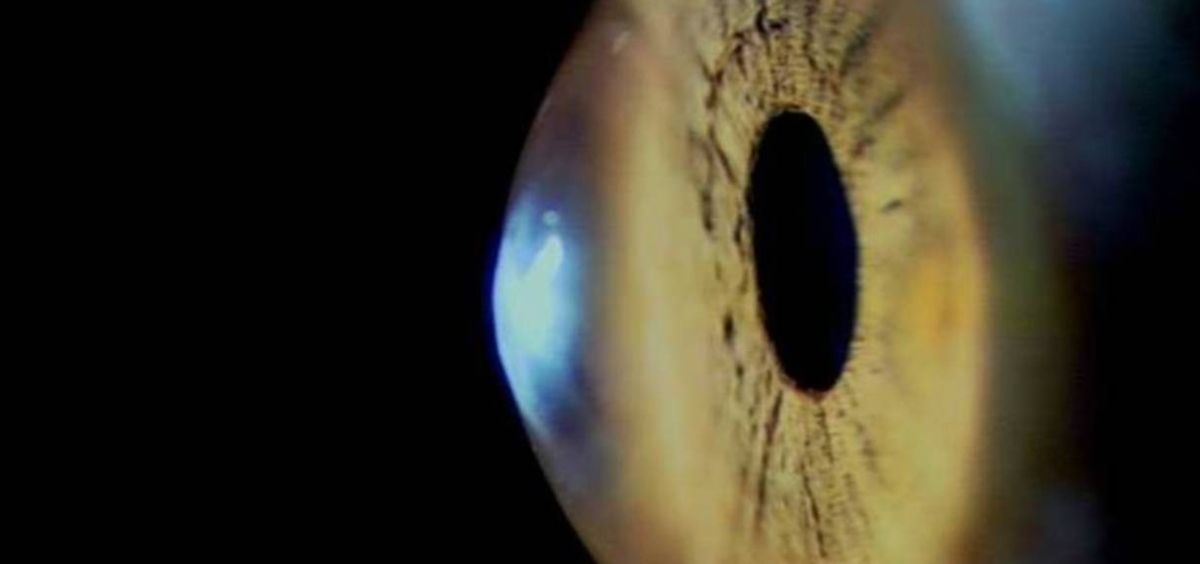 Desarrollan un iris artificial que corrige los trastornos de la visión (Foto. CSIC)