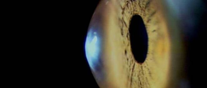 Desarrollan un iris artificial que corrige los trastornos de la visión (Foto. CSIC)