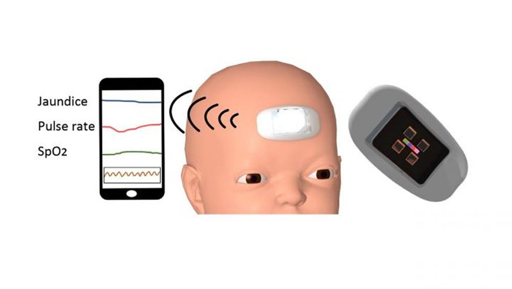 Primer sensor portátil para recién nacidos que es capaz de medir continuamente la bilirrubina. (Foto. Universidad Nacional de Yokohama) 