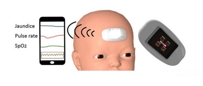 Primer sensor portátil para recién nacidos que es capaz de medir continuamente la bilirrubina. (Foto. Universidad Nacional de Yokohama) 