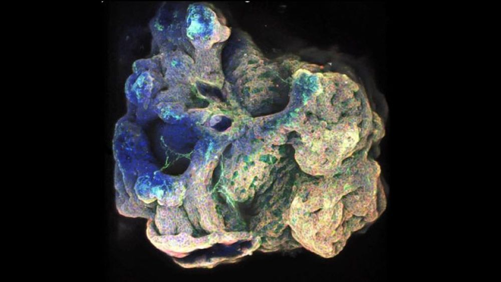 Imagen del organoide (Foto. Universidad de Cambridge)