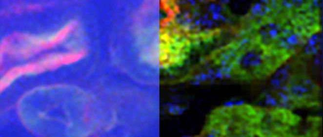 Imagen de la comparativa de la captación de tejido renal con microscopia de dos fotones convencional (izquierda) y la técnica profudna desarrollada por el estudio (derecha). (Foto. MIT)