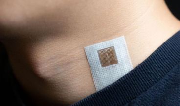 Este parche para la piel utiliza ultrasonidos para medir señales cardiovasculares. (Foto. Nature Biomedical Engineering. Universidad de California San Diego)