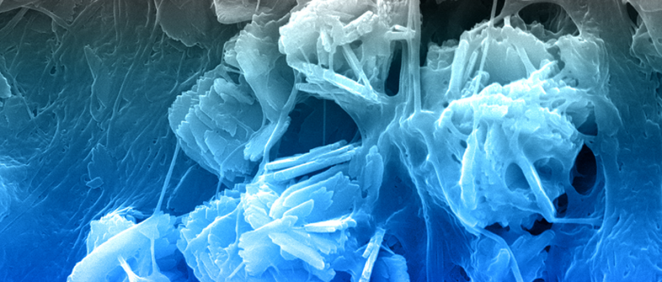 Imagen de microscopio electrónico del andamio de colágeno mineralizado que muestra los cristales minerales y las fibras de colágeno. El color ha sido añadido por los investigadores (Foto: Marley Dewey)