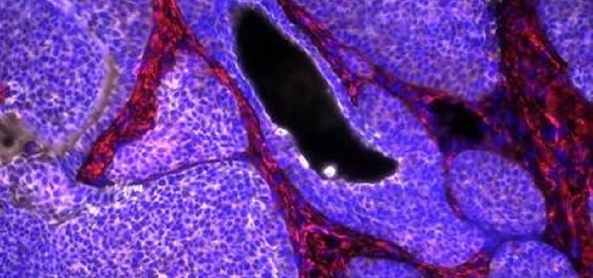 Imagen de un tumor (Foto: IN-CSIC-UMH)