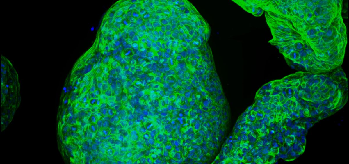 Desarrollan un gel sintético que se puede utilizar para cultivar pequeños organoides pancreáticos a partir de células humanas (Foto. MIT)