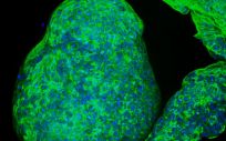 Desarrollan un gel sintético que se puede utilizar para cultivar pequeños organoides pancreáticos a partir de células humanas (Foto. MIT)