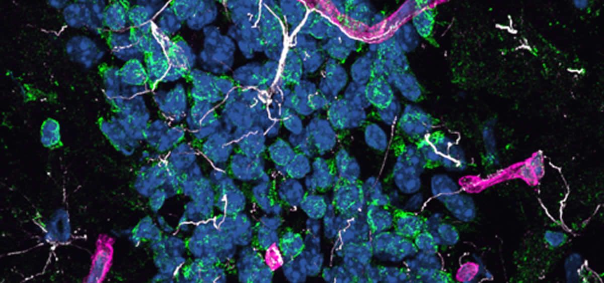Investigan el origen de la neurodegeneración del alzhéimer (Foto. John Charles Louis Mamo)