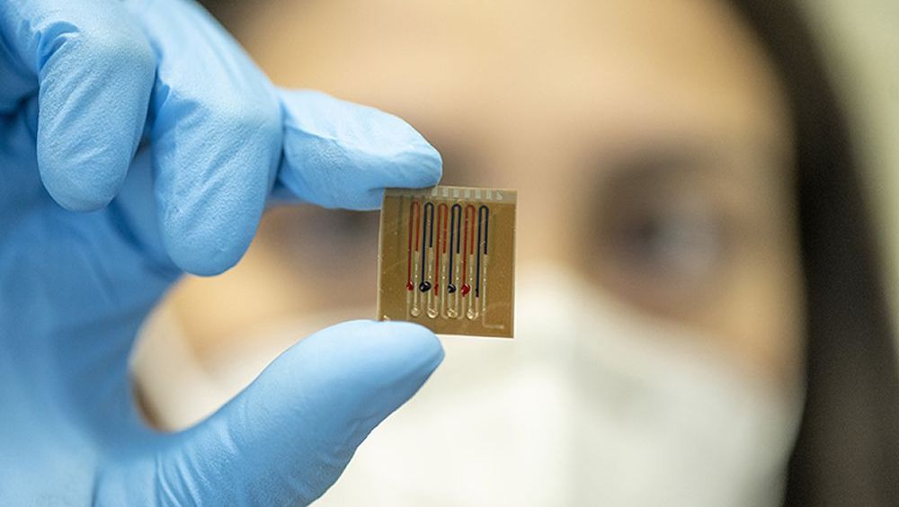 Una imagen del chip (Foto. Universidad de Friburgo)
