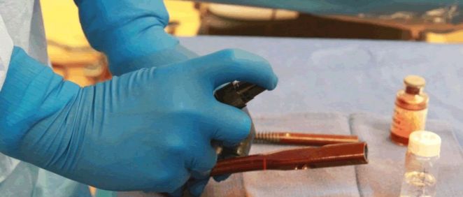 Un revestimiento antimicrobiano para implantes ortopédicos previene infecciones peligrosas (Foto. Universidad de Duke)