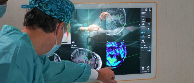 El Dr. Ricardo Díez Valle planificando la cirugía craneal con el neuronavegador Brainlab. (Foto. Hospital Ruber Internacional)