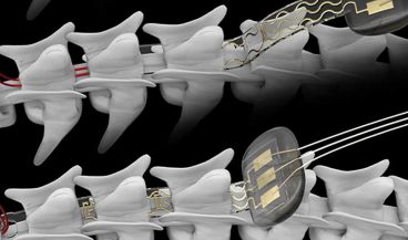 Científicos suizos desarrollan un implante fotoeléctrico inalámbrico (Foto. EPFL)