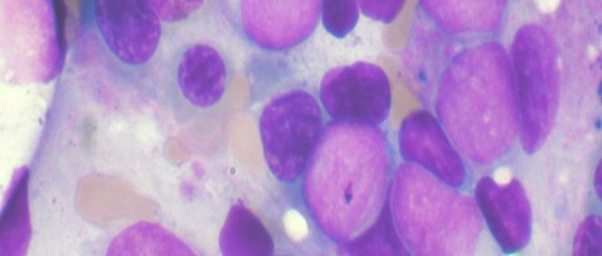 Células de cáncer (Goyo. Archivo Ciber)