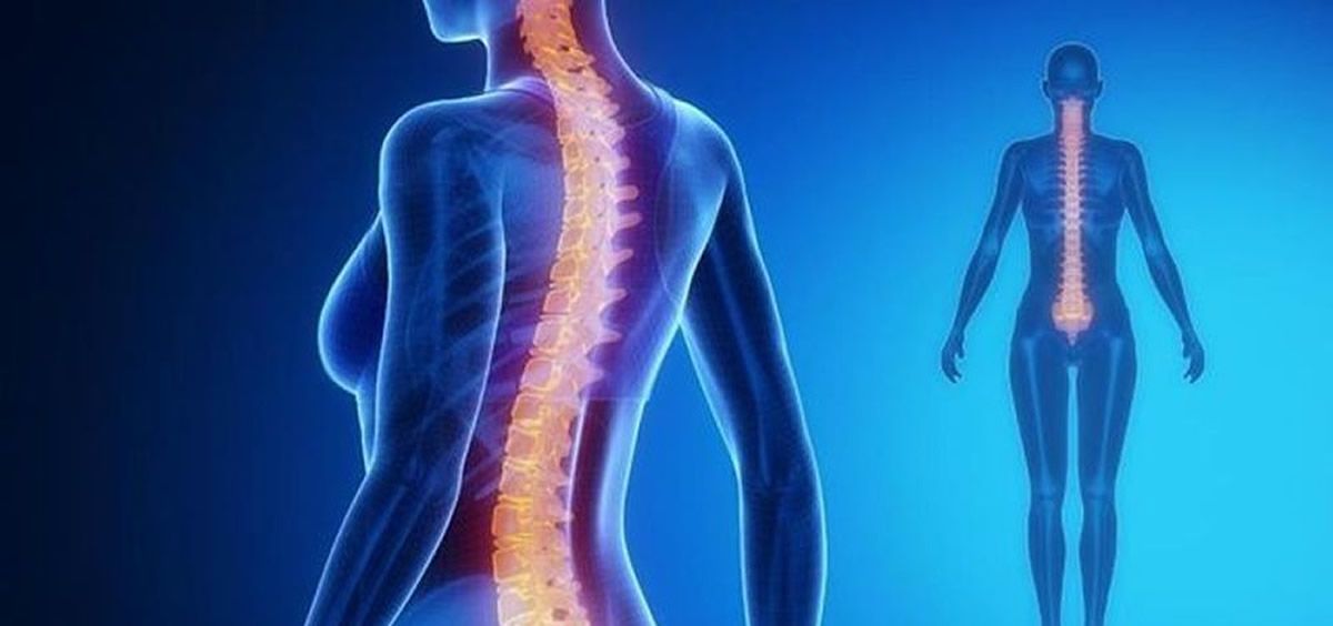 Un implante electrónico reactiva los nervios de la médula espinal