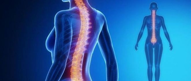 Un implante electrónico reactiva los nervios de la médula espinal
