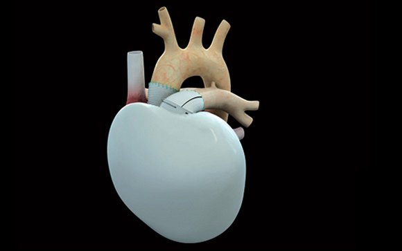 El primer paciente con un corazón artificial bioprotésico de Carmat evoluciona favorablemente