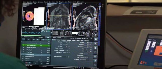 Inteligencia Artificial para detectar enfermedades del corazón (Foto. University College de Londres)