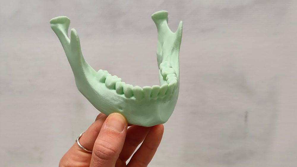 Servicio integral de impresión 3D flexible para cirugía y prótesis (Foto. AIMPLAS)