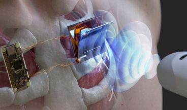 Ilustración esquemática de la carga inalámbrica de un dispositivo electrónico implantado en el cuerpo mediante una sonda ultrasónica (Foto. Instituto de Ciencia y Tecnología de Corea (KIST))