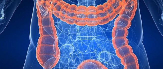 Un modelo de IA predice si la enfermedad de Crohn reaparecerá tras la cirugía
