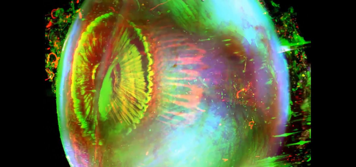 Imagen de un ojo humano en 3D clarificado y de alta resolución (Foto. Investigación 'Sondeo celular y molecular de órganos humanos intactos')
