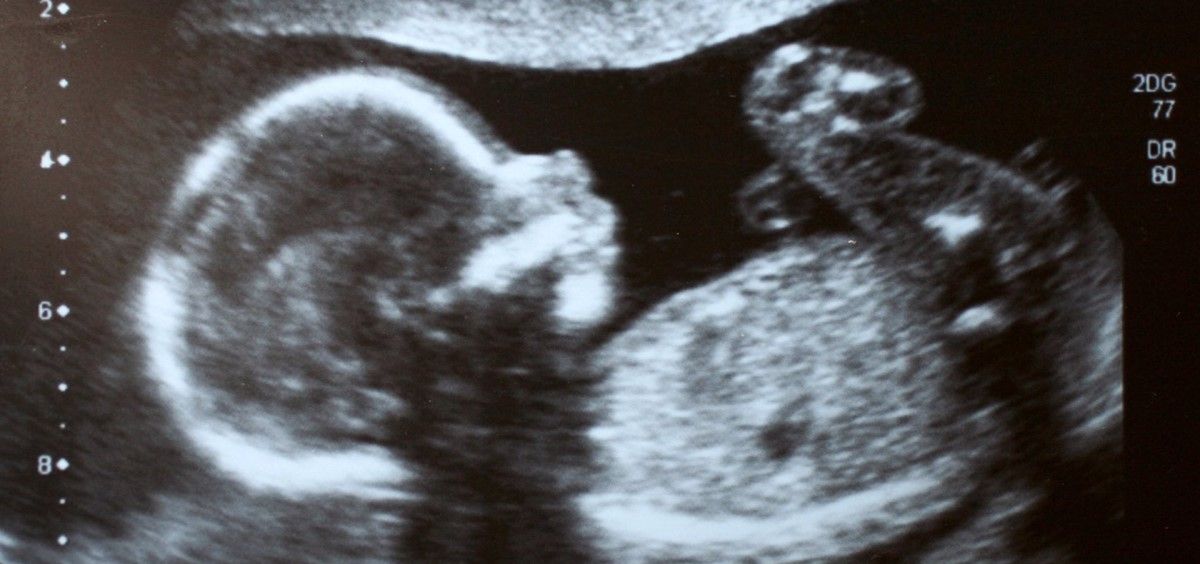 IA  y ecografía de un bebé. (Foto. Istock)