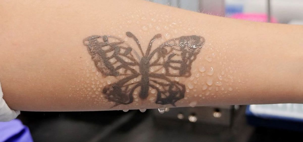 Tatuaje controla la salud (Foto. Reuters). jpg