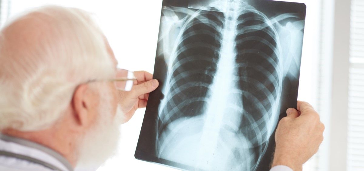 Profesional sanitario mirando una placa de pulmón (Foto: Freepik)