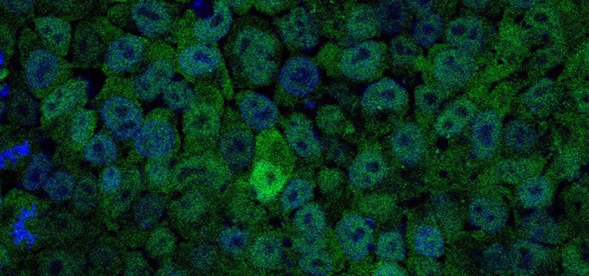 Imagen de células madre embrionarias con bajos niveles de PI3K (Foto: Ana Clara Carrera- Archivo)