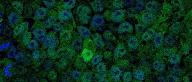 Imagen de células madre embrionarias con bajos niveles de PI3K (Foto: Ana Clara Carrera- Archivo)