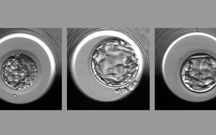 Ejemplos de embriones evaluados por el algoritmo STORK A (Foto. Weill Cornell Medicine)