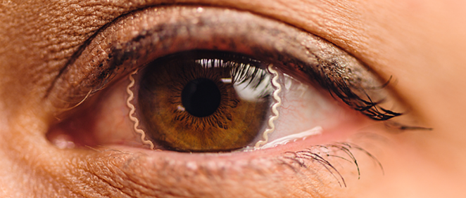 Lentillas inteligentes que permiten prevenir y tratar el glaucoma. (Fuente: Purdue)