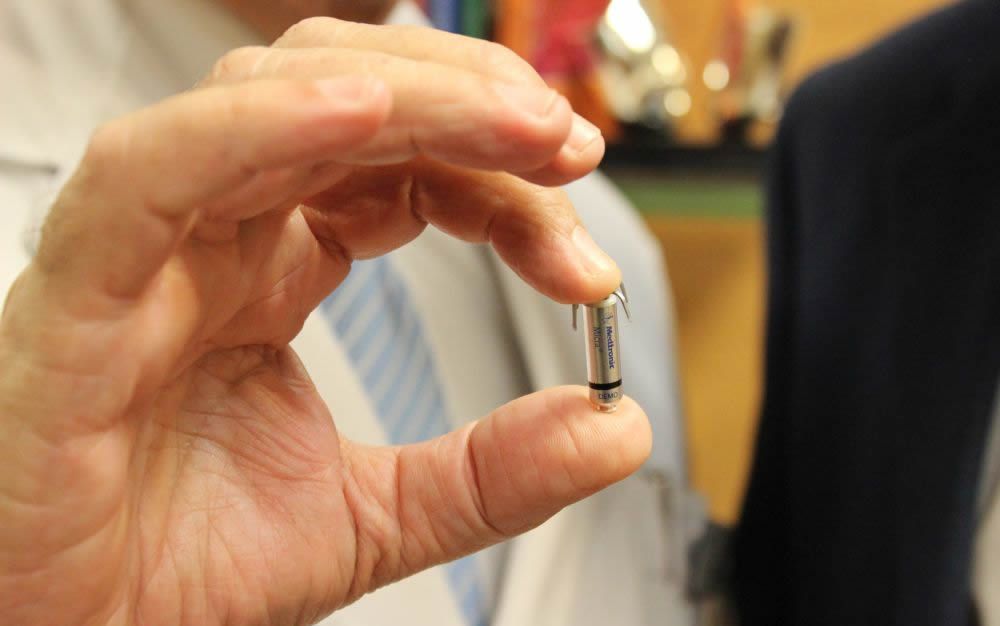 Implantan en Madrid el marcapasos sin cables más pequeño del mundo