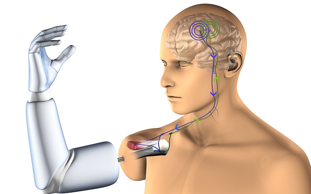 Diseñan la primera prótesis que se conecta con huesos, nervios y músculos